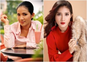 Áp lực xã hội và phẫu thuật thẩm mỹ
